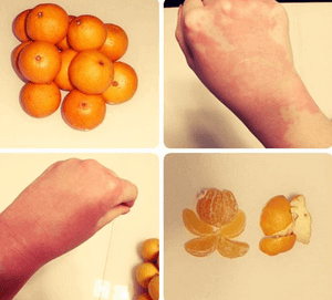 Что делать при отравление мандаринами ребенку и взрослому — симптомы