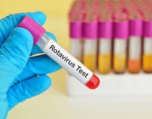 Инкубационный период ротавирусной инфекции у взрослых и детей — длительность