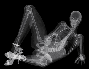 Как часто можно делать рентгеновские снимки без вреда