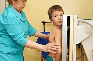 Опасен ли рентген для детей — сколько раз в год можно делать ?