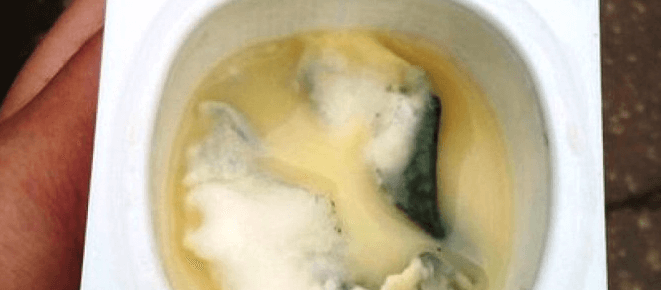 Отравление йогуртом (просроченным) — методы лечения, последствия