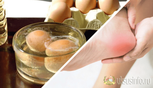Уксус с яйцом и маслом: проверенное народное средство от пяточной шпоры